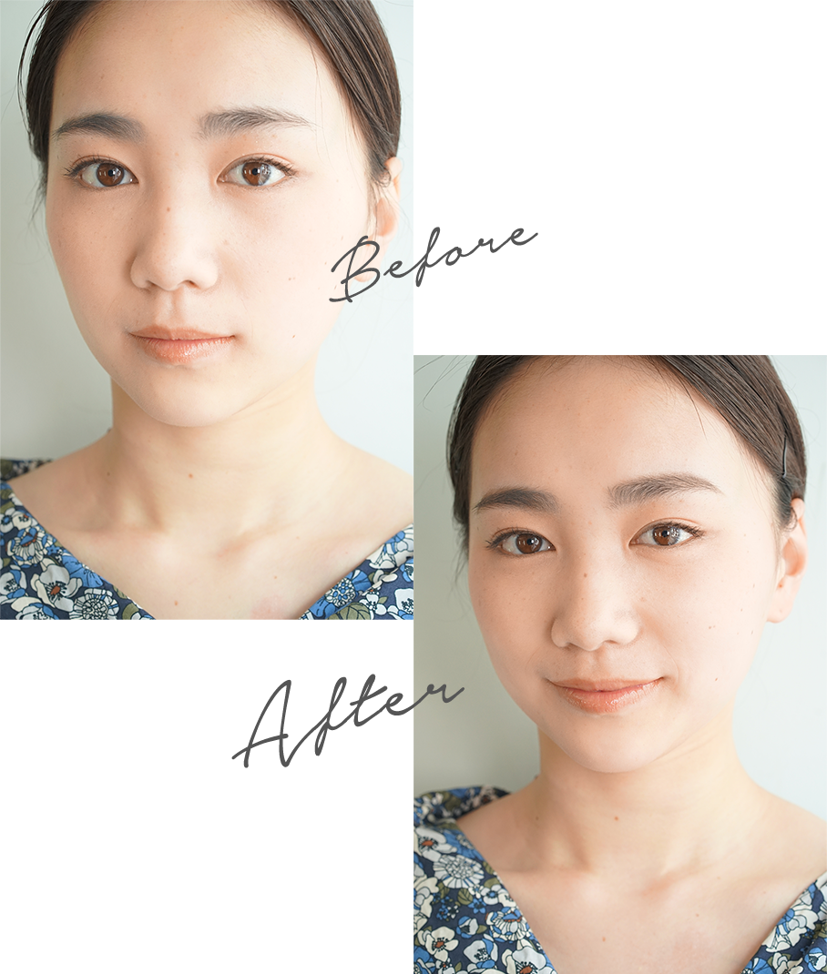 ビフォーアフター